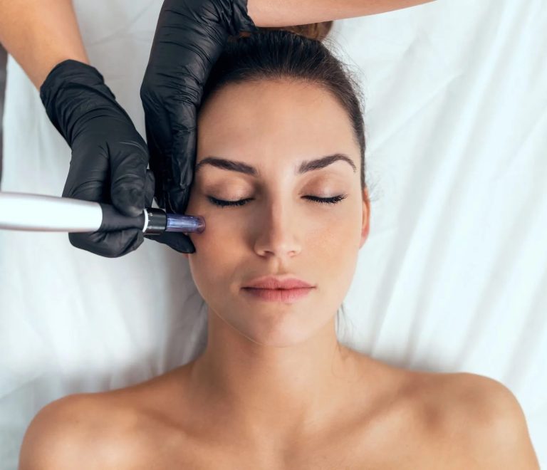 Revealing the Truth About Microneedling: Myths and Facts
